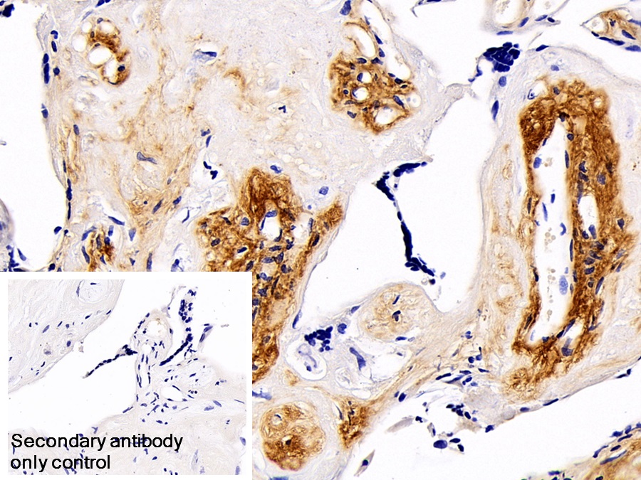 Monoclonal Antibody to Procollagen III N-Terminal Propeptide (PIIINP)