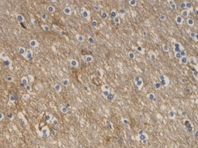 Monoclonal Antibody to Aquaporin 4 (AQP4)