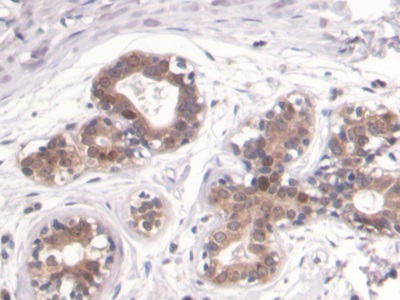 Monoclonal Antibody to Proliferating Cell Nuclear Antigen (PCNA)