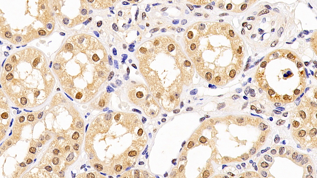 Monoclonal Antibody to Proliferating Cell Nuclear Antigen (PCNA)