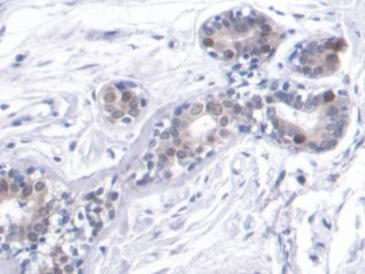 Monoclonal Antibody to Proliferating Cell Nuclear Antigen (PCNA)