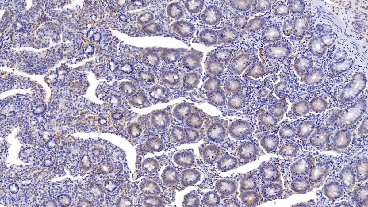 Monoclonal Antibody to Myeloperoxidase (MPO)