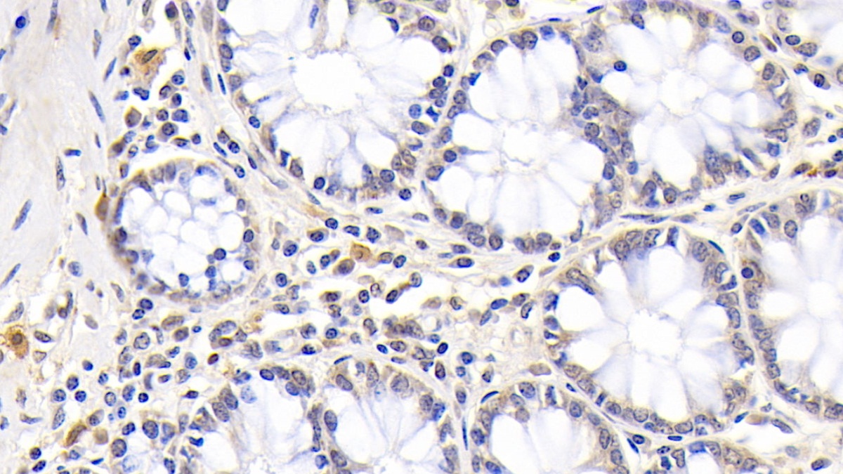 Monoclonal Antibody to Myeloperoxidase (MPO)