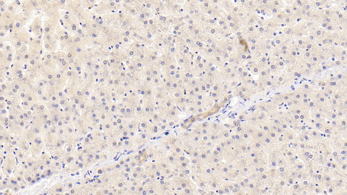 Monoclonal Antibody to Apolipoprotein B100 (APOB100)