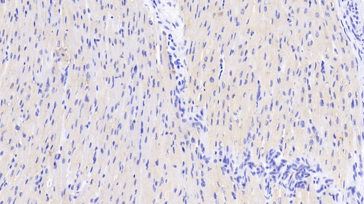 Monoclonal Antibody to Adiponectin (ADPN)