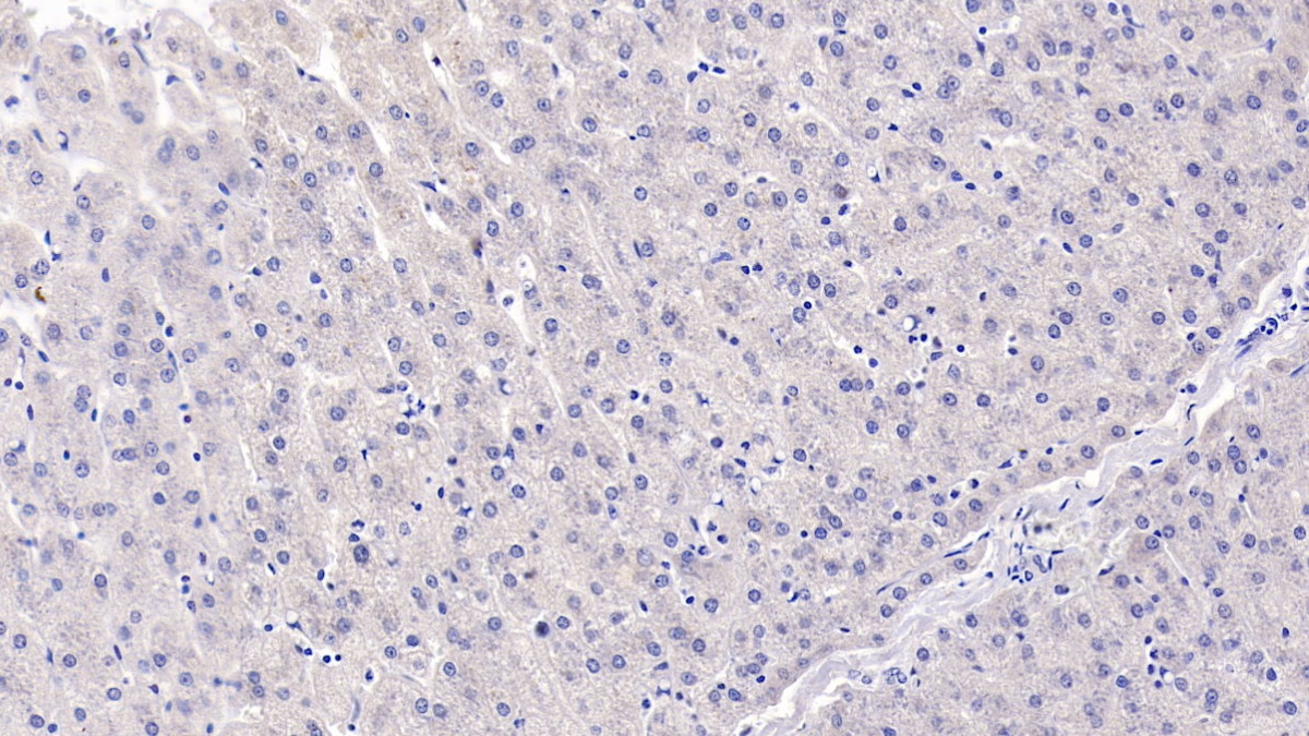 Monoclonal Antibody to Visfatin (VF)