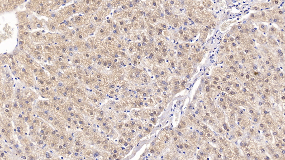 Monoclonal Antibody to Visfatin (VF)