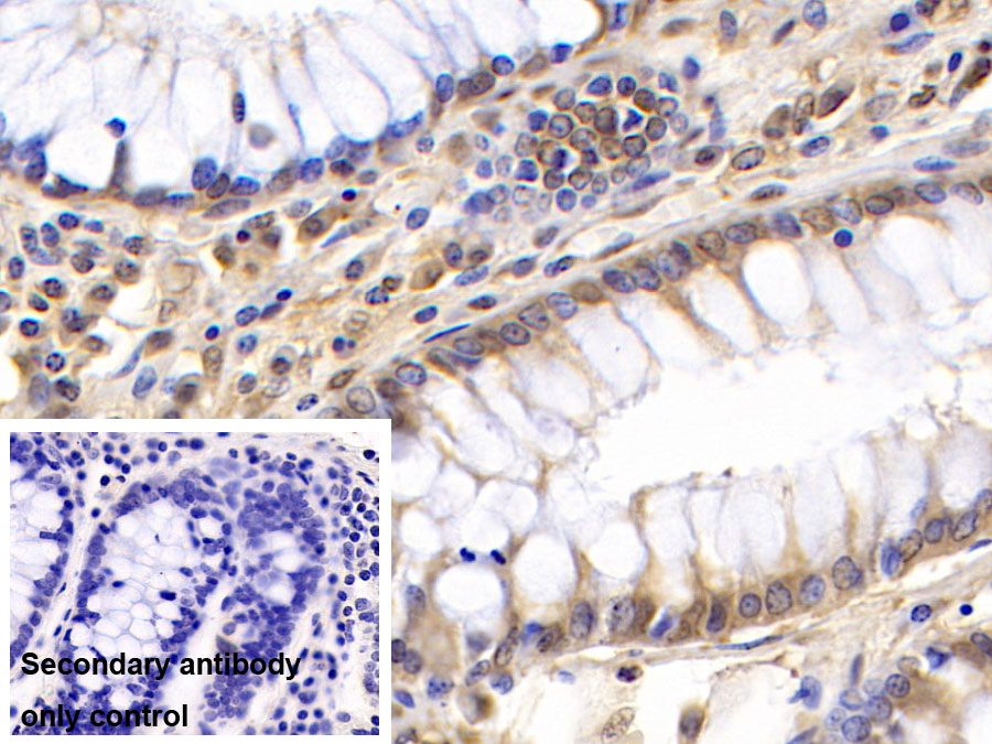 Monoclonal Antibody to Visfatin (VF)