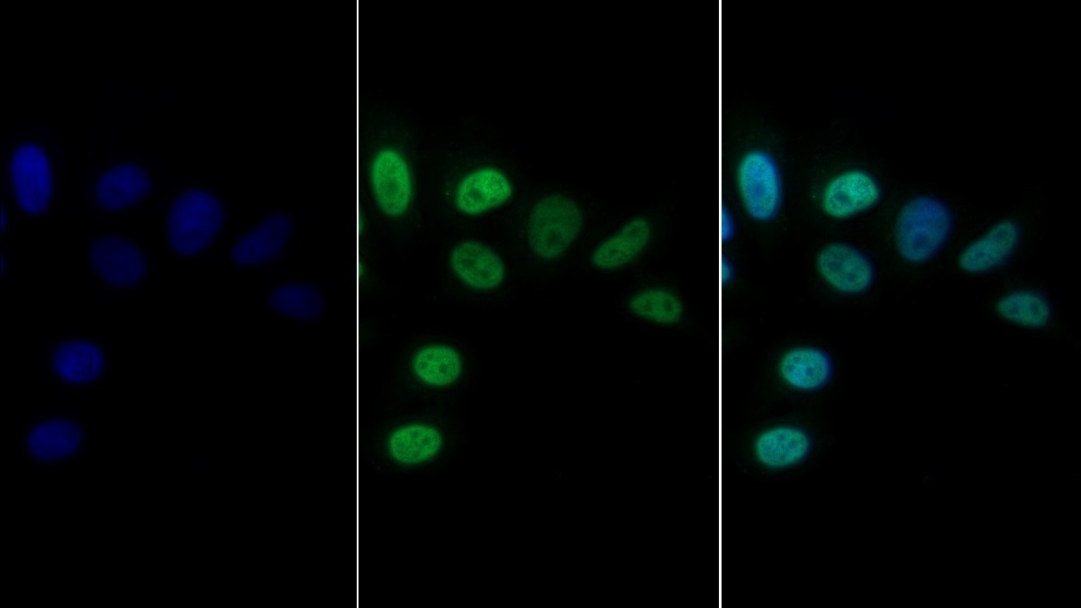 Monoclonal Antibody to CCAAT/Enhancer Binding Protein Alpha (CEBPa)