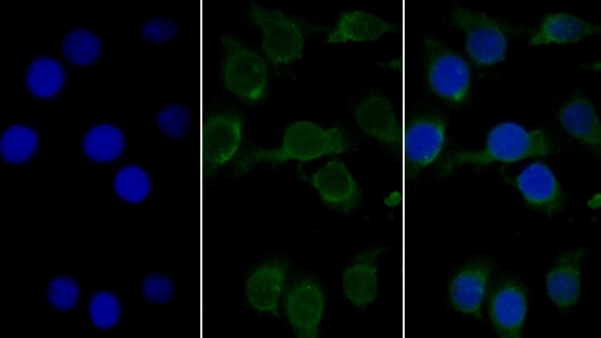 Monoclonal Antibody to Complement component 1 Q subcomponent-binding protein, mitochondrial (C1QBP)