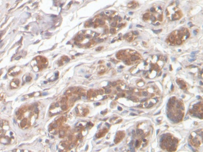 Monoclonal Antibody to Complement component 1 Q subcomponent-binding protein, mitochondrial (C1QBP)