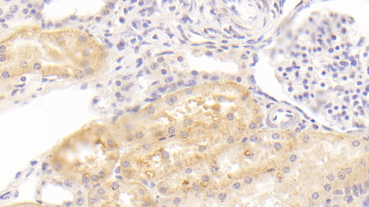 Monoclonal Antibody to Amiloride Binding Protein 1 (ABP1)