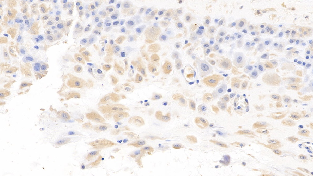 Monoclonal Antibody to Interleukin 7 (IL7)