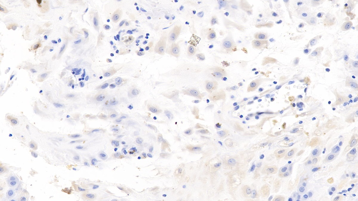 Monoclonal Antibody to Interleukin 7 (IL7)