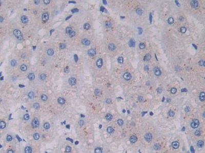 Monoclonal Antibody to Cross Linked C-Telopeptide Of Type I Collagen (CTXI)