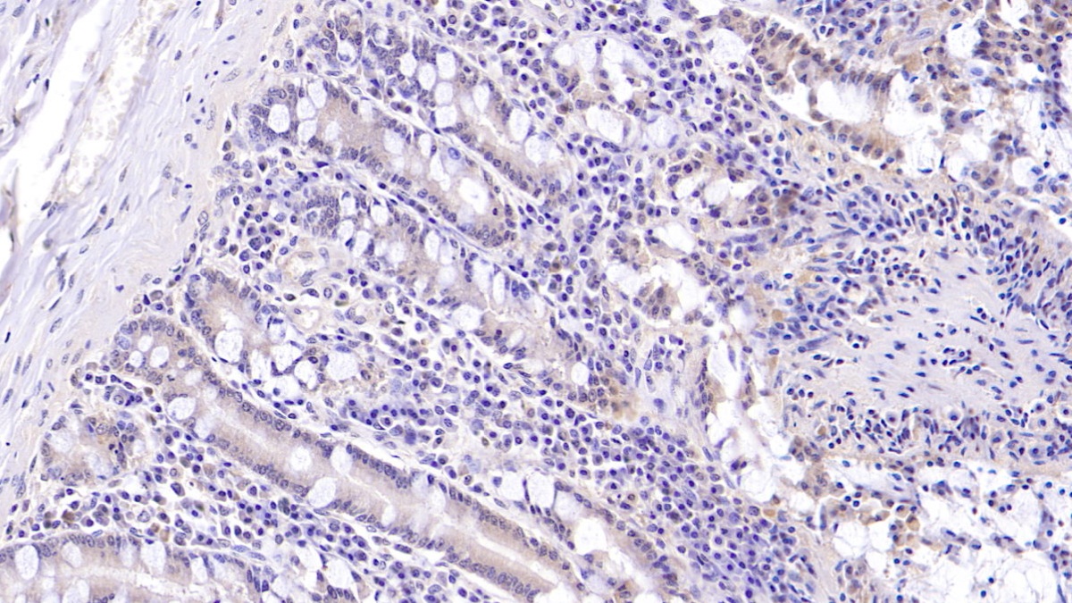 Monoclonal Antibody to Mucin 5 Subtype B (MUC5B)