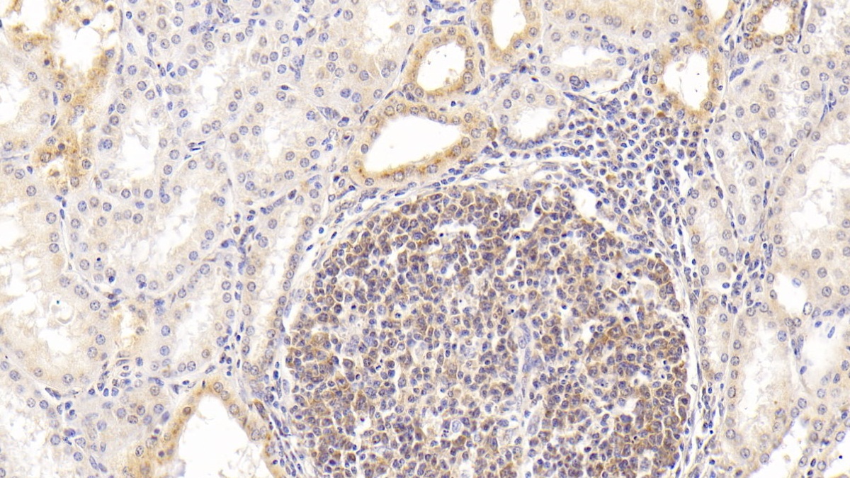 Monoclonal Antibody to Procalcitonin (PCT)