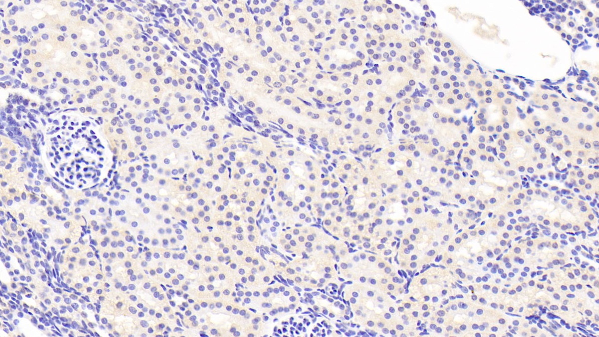 Monoclonal Antibody to Procalcitonin (PCT)