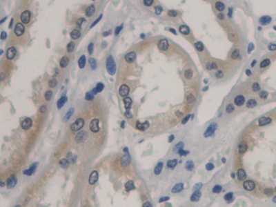 Monoclonal Antibody to Procalcitonin (PCT)