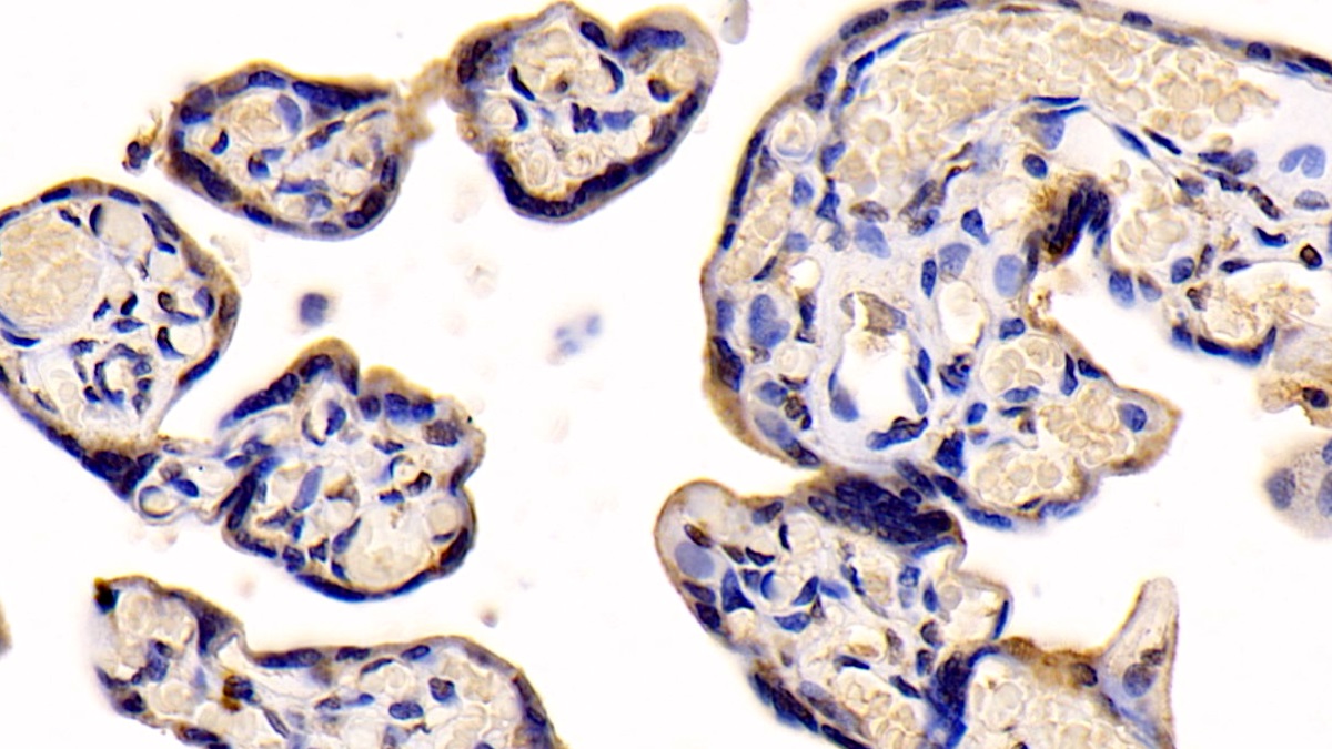 Monoclonal Antibody to Neuropilin 1 (NRP1)