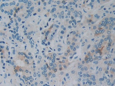 Monoclonal Antibody to Heat Shock Protein 27 (Hsp27)