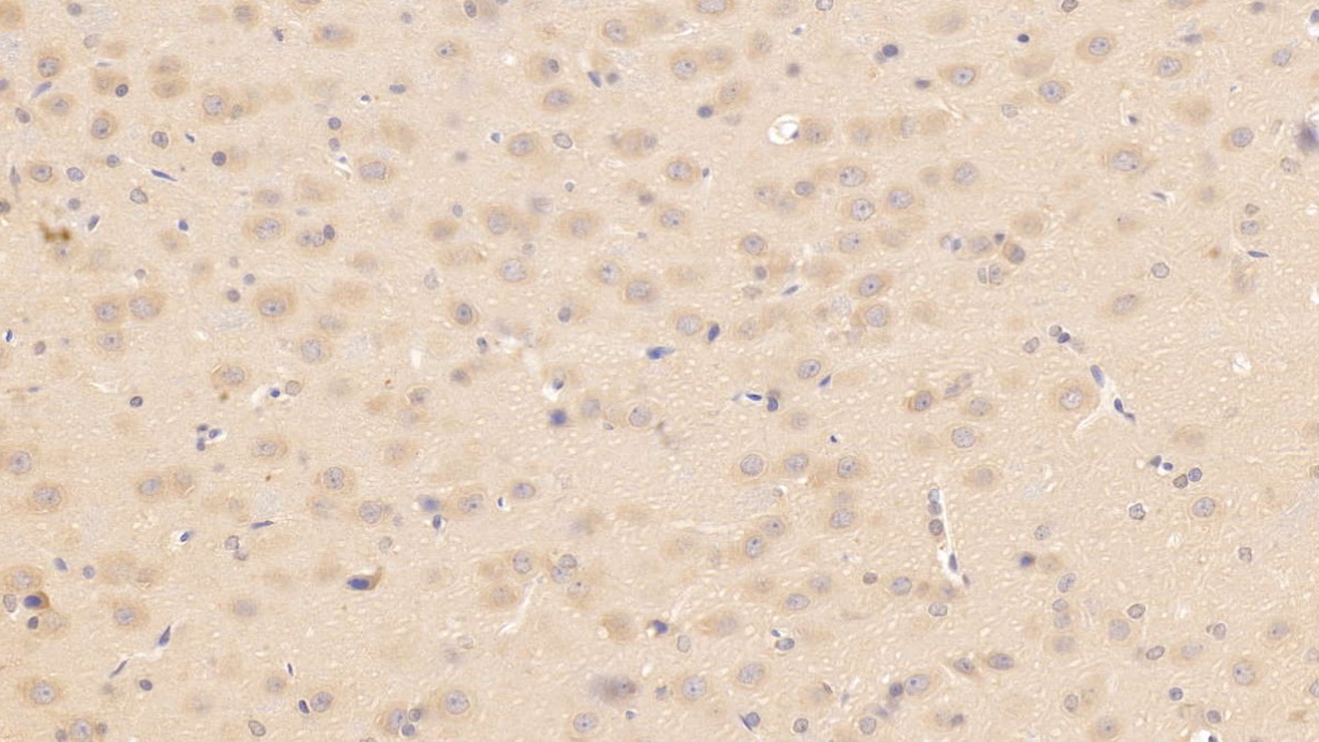 Monoclonal Antibody to Apolipoprotein E (APOE)