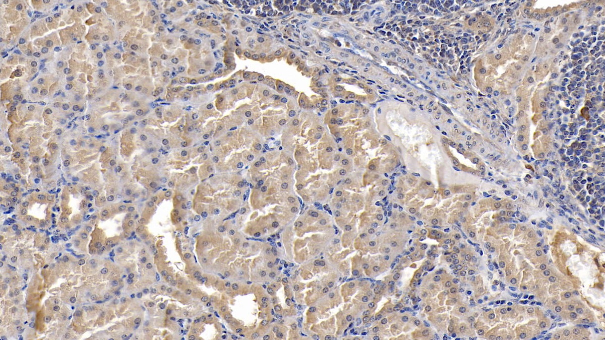 Monoclonal Antibody to Apolipoprotein E (APOE)