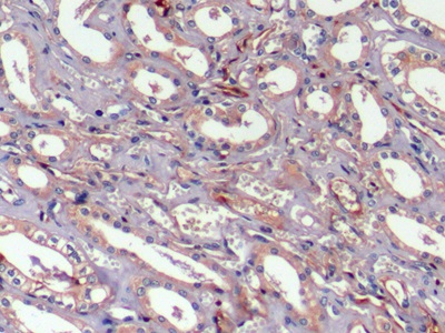 Monoclonal Antibody to Prothrombin Fragment 1+2 (F1+2)