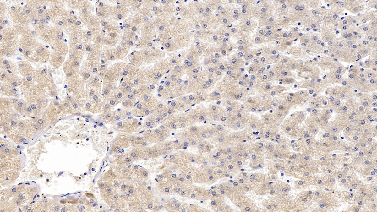 Monoclonal Antibody to Prothrombin Fragment 1+2 (F1+2)