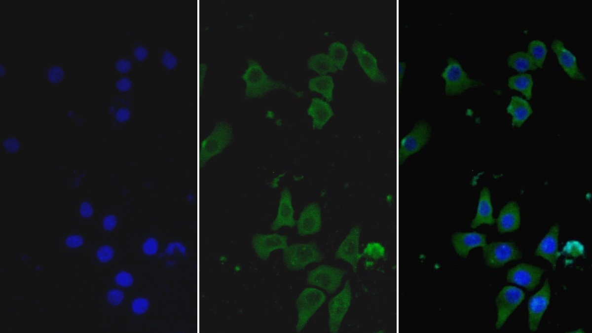 Monoclonal Antibody to Heparanase (HPSE)