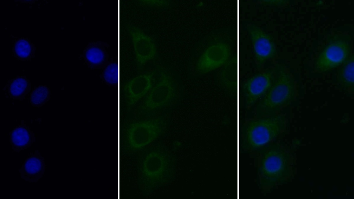 Monoclonal Antibody to Heparanase (HPSE)