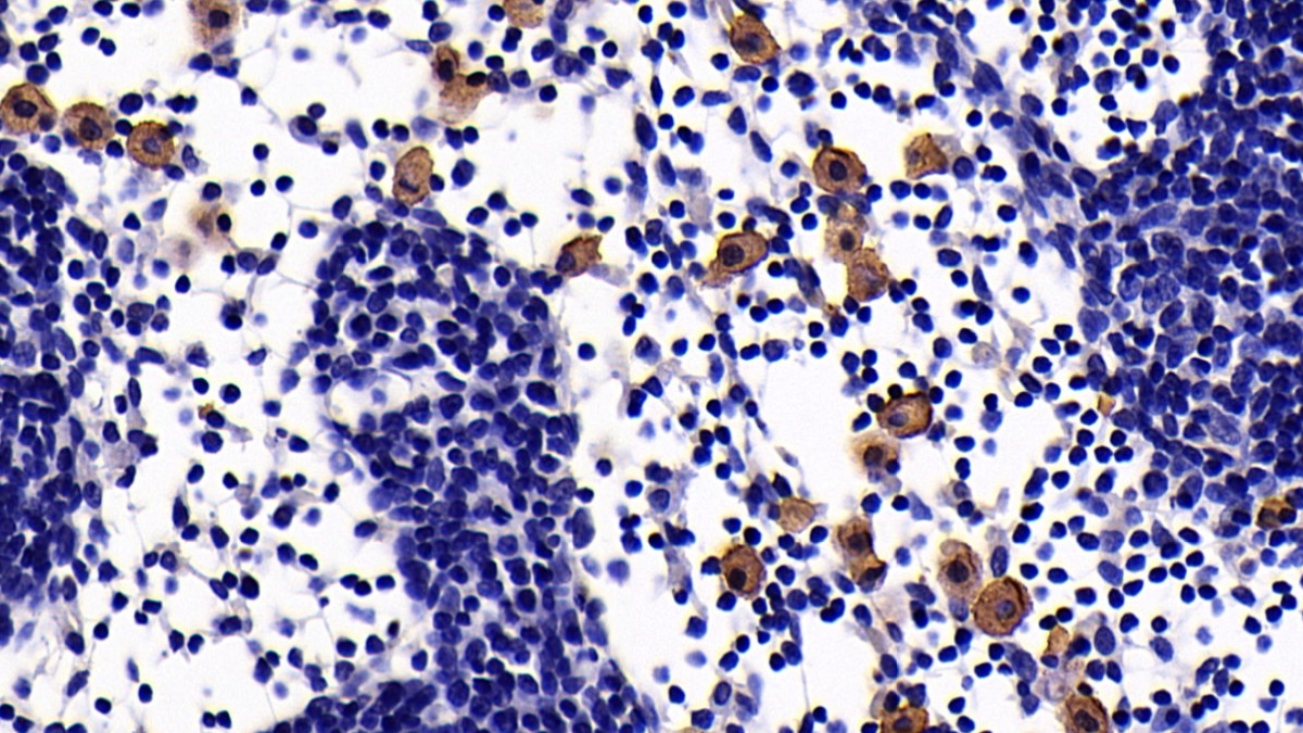 Monoclonal Antibody to Complement Receptor 2 (CD21)