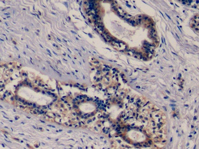 Monoclonal Antibody to Epidermal Growth Factor Receptor (EGFR)