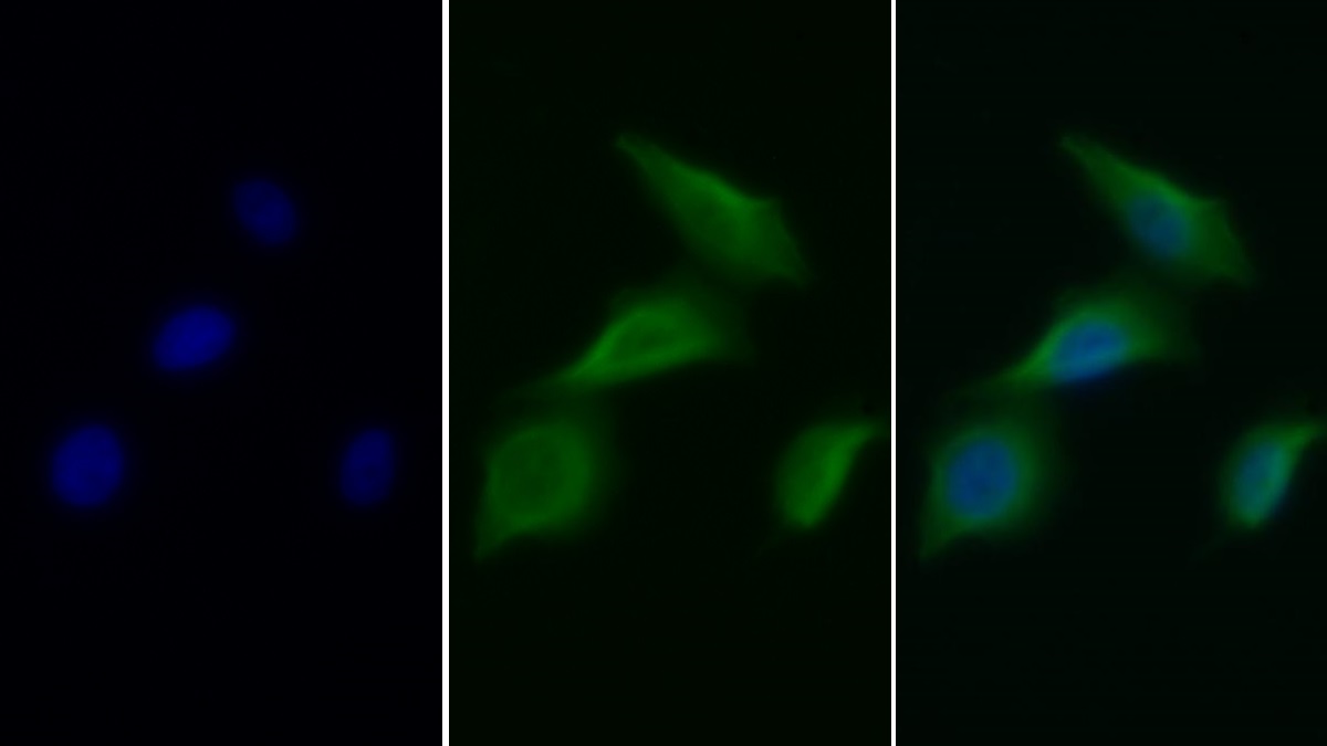 Monoclonal Antibody to Epidermal Growth Factor Receptor (EGFR)