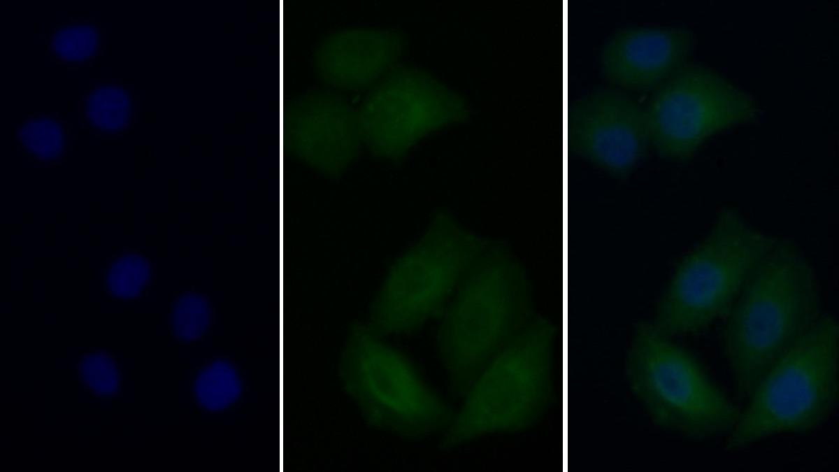 Monoclonal Antibody to Epidermal Growth Factor Receptor (EGFR)