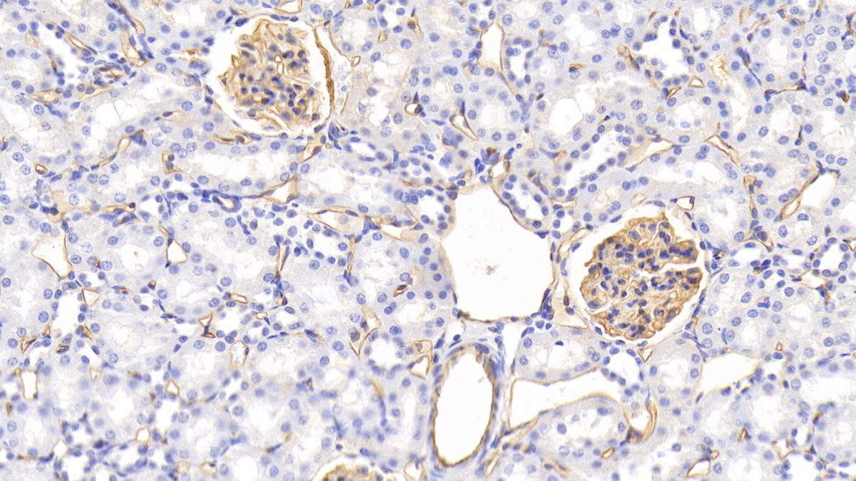 Monoclonal Antibody to Podocalyxin (PODXL)