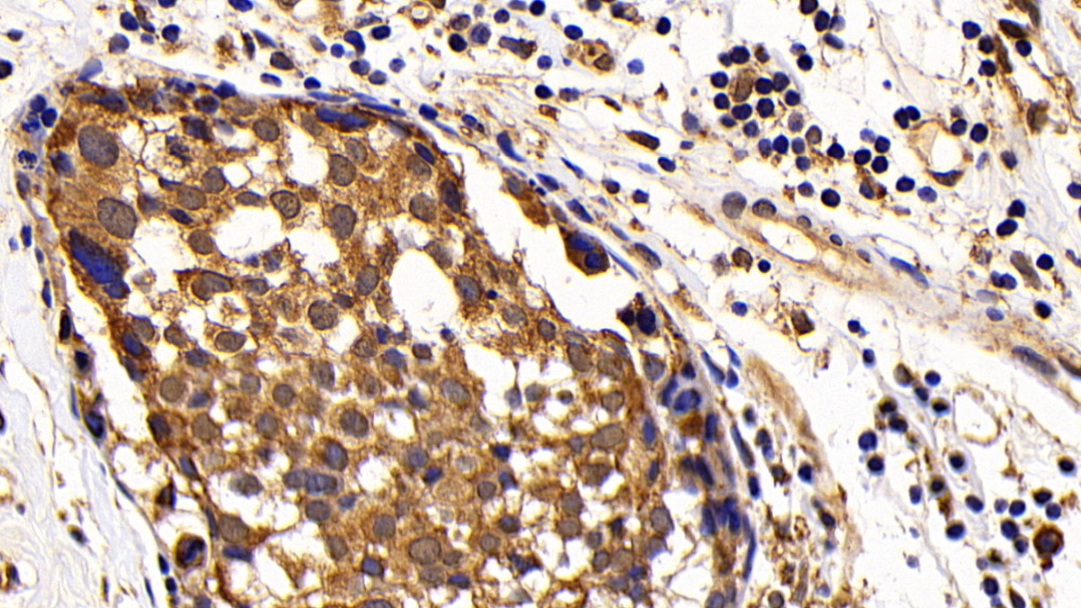 Monoclonal Antibody to B-Cell Leukemia/Lymphoma 2 (Bcl2)