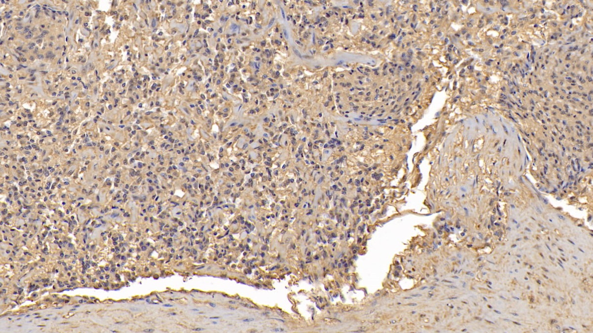 Monoclonal Antibody to B-Cell Leukemia/Lymphoma 2 (Bcl2)