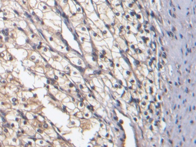 Monoclonal Antibody to Bone Morphogenetic Protein 7 (BMP7)