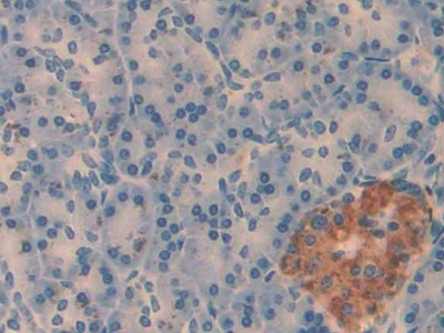 Monoclonal Antibody to Amylin