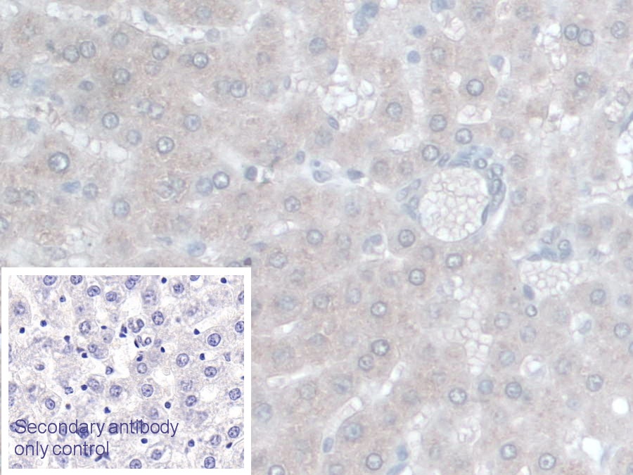 Monoclonal Antibody to Alpha-1-Acid Glycoprotein (a1AGP)