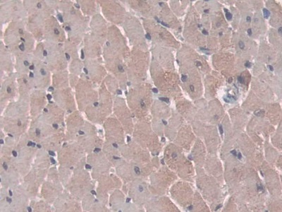 Monoclonal Antibody to Alpha-1-Acid Glycoprotein (a1AGP)