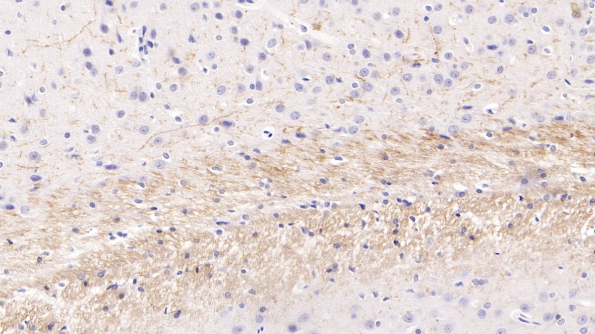 Monoclonal Antibody to Parathyroid Hormone Related Protein (PTHrP)