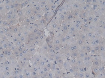 Monoclonal Antibody to Coagulation Factor II (F2)