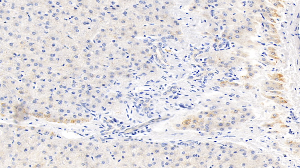 Monoclonal Antibody to C Reactive Protein (CRP)