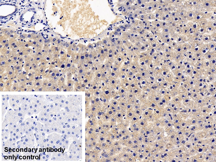 Monoclonal Antibody to C Reactive Protein (CRP)