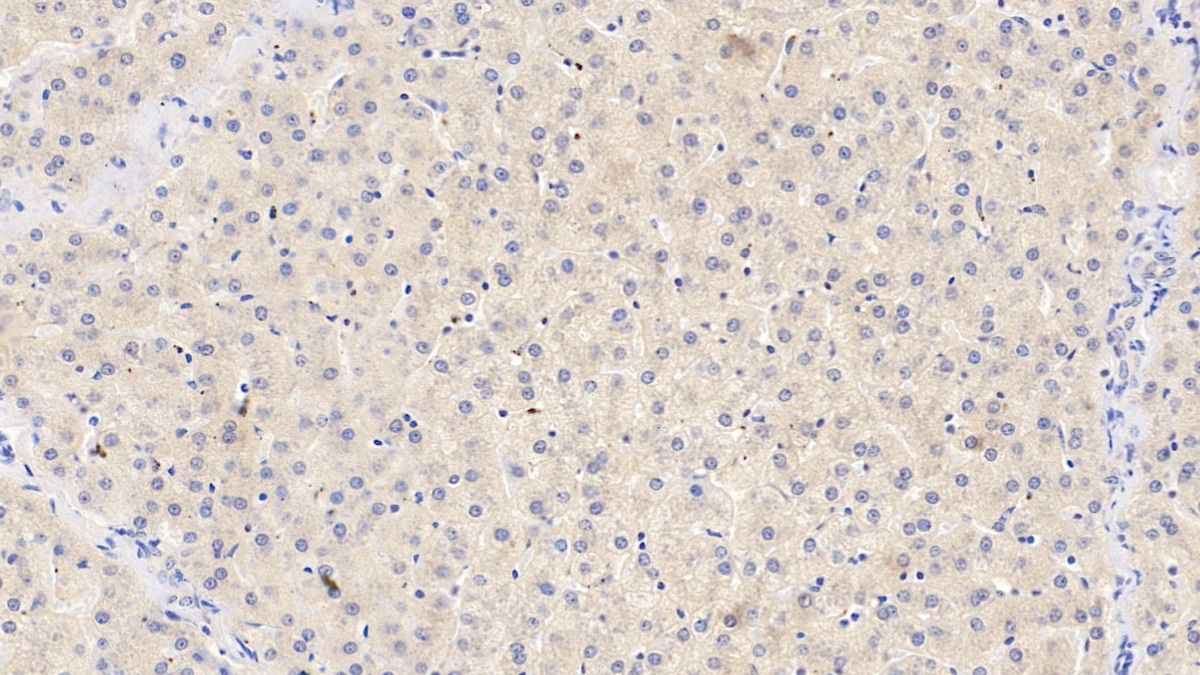 Monoclonal Antibody to C Reactive Protein (CRP)