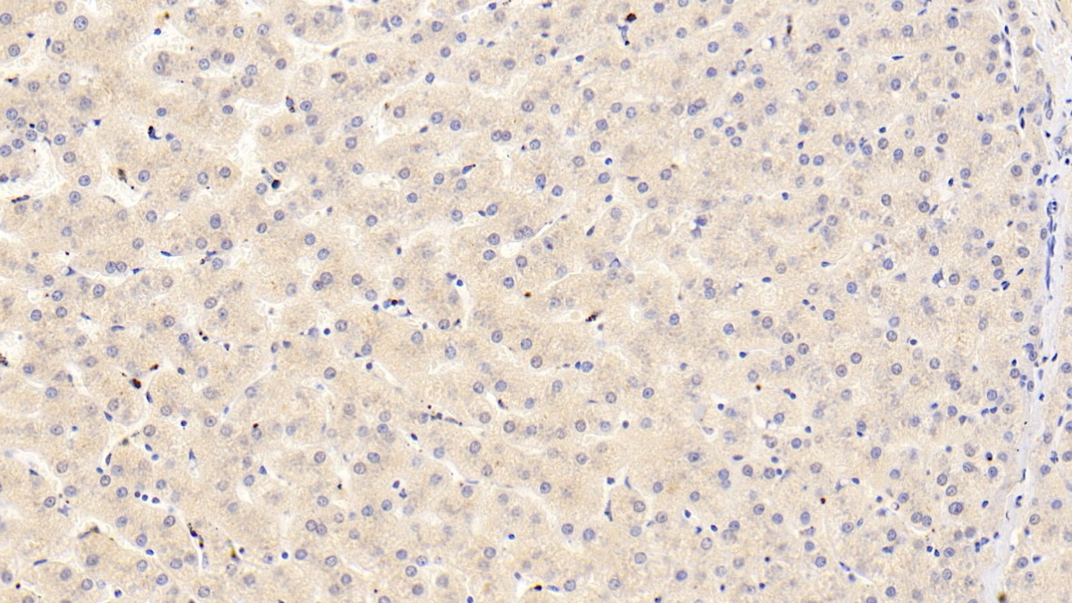 Monoclonal Antibody to C Reactive Protein (CRP)