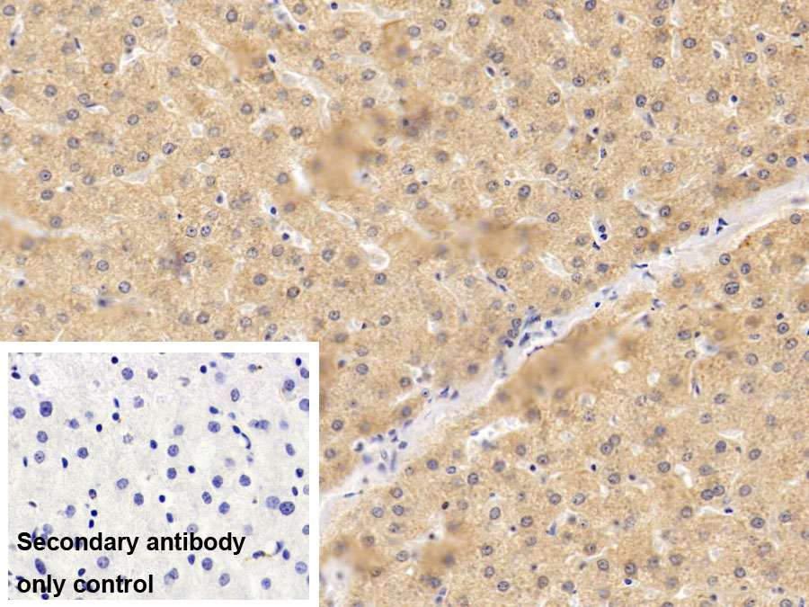 Monoclonal Antibody to C Reactive Protein (CRP)