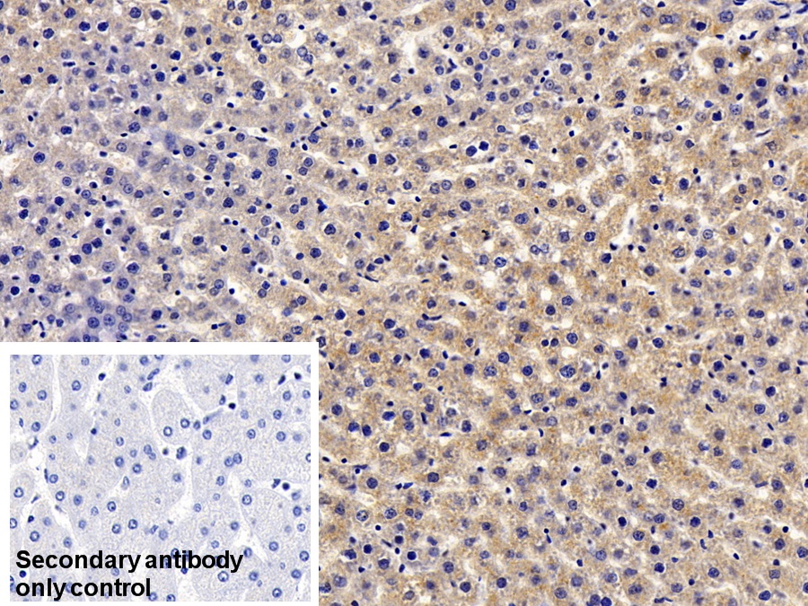 Monoclonal Antibody to C Reactive Protein (CRP)